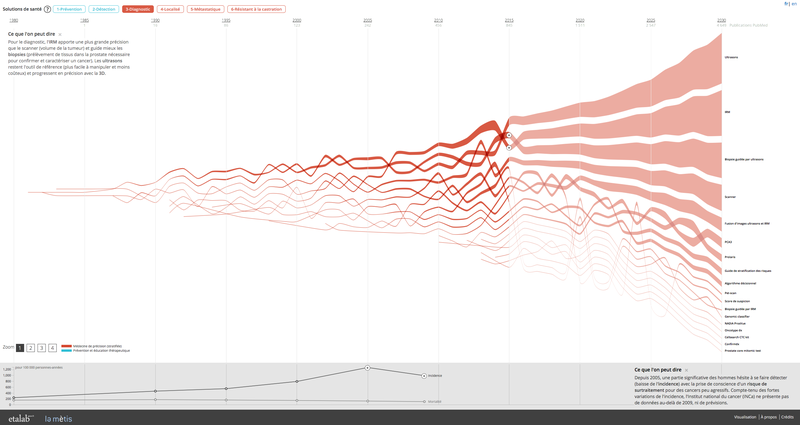 Cancer de la prostate : 30 ans d'innovation, et après ?
